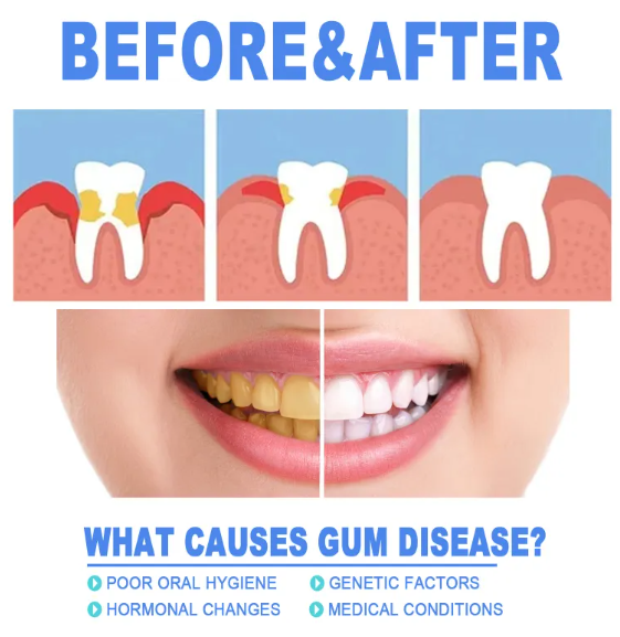 Teeth Repair Gel